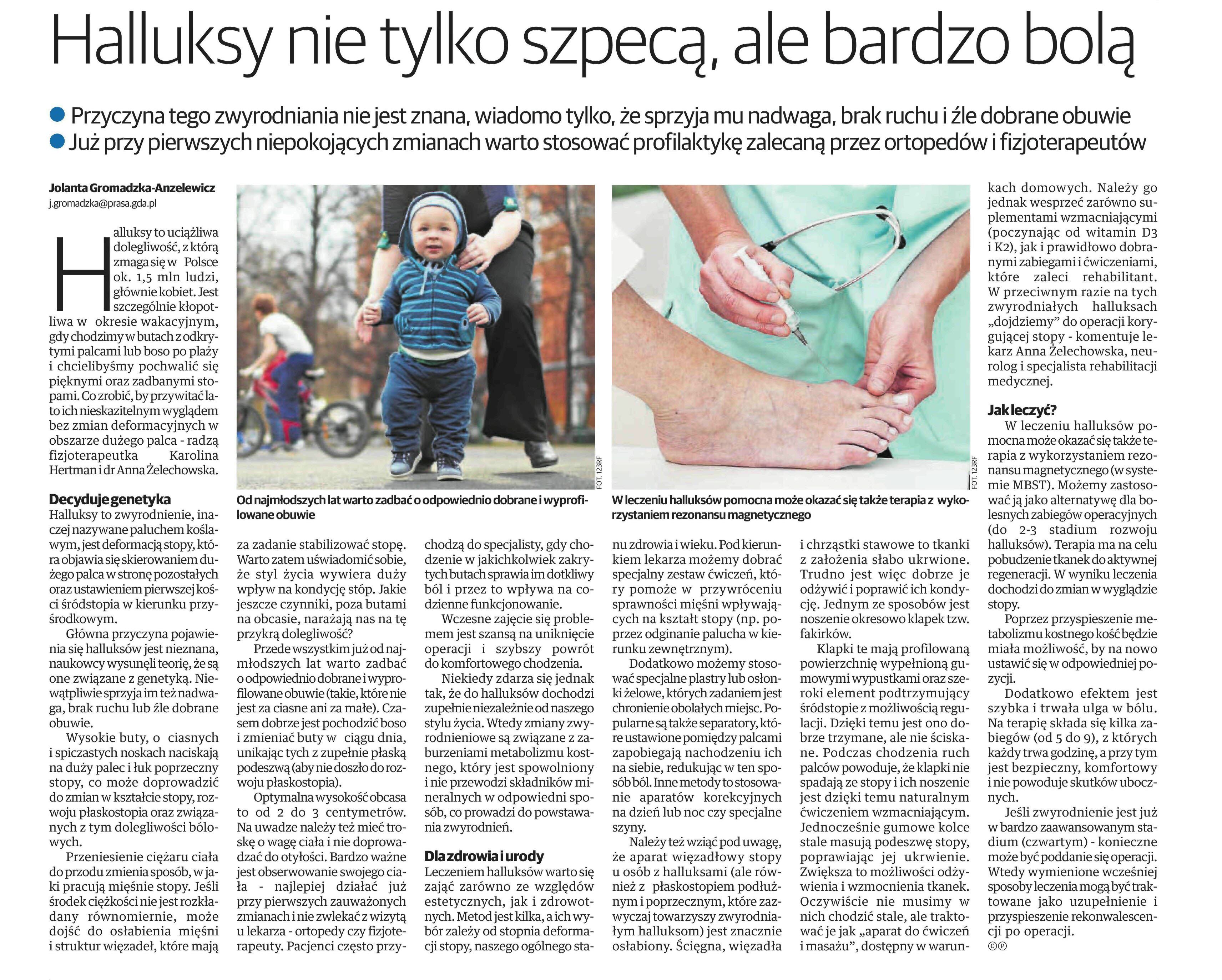 dziennik_baltycki_poradnik_na_zdrowie_2017_06_16_halluksy_nie_tylko_szpeca__ale_bardzo_bola__jpg_bn_1