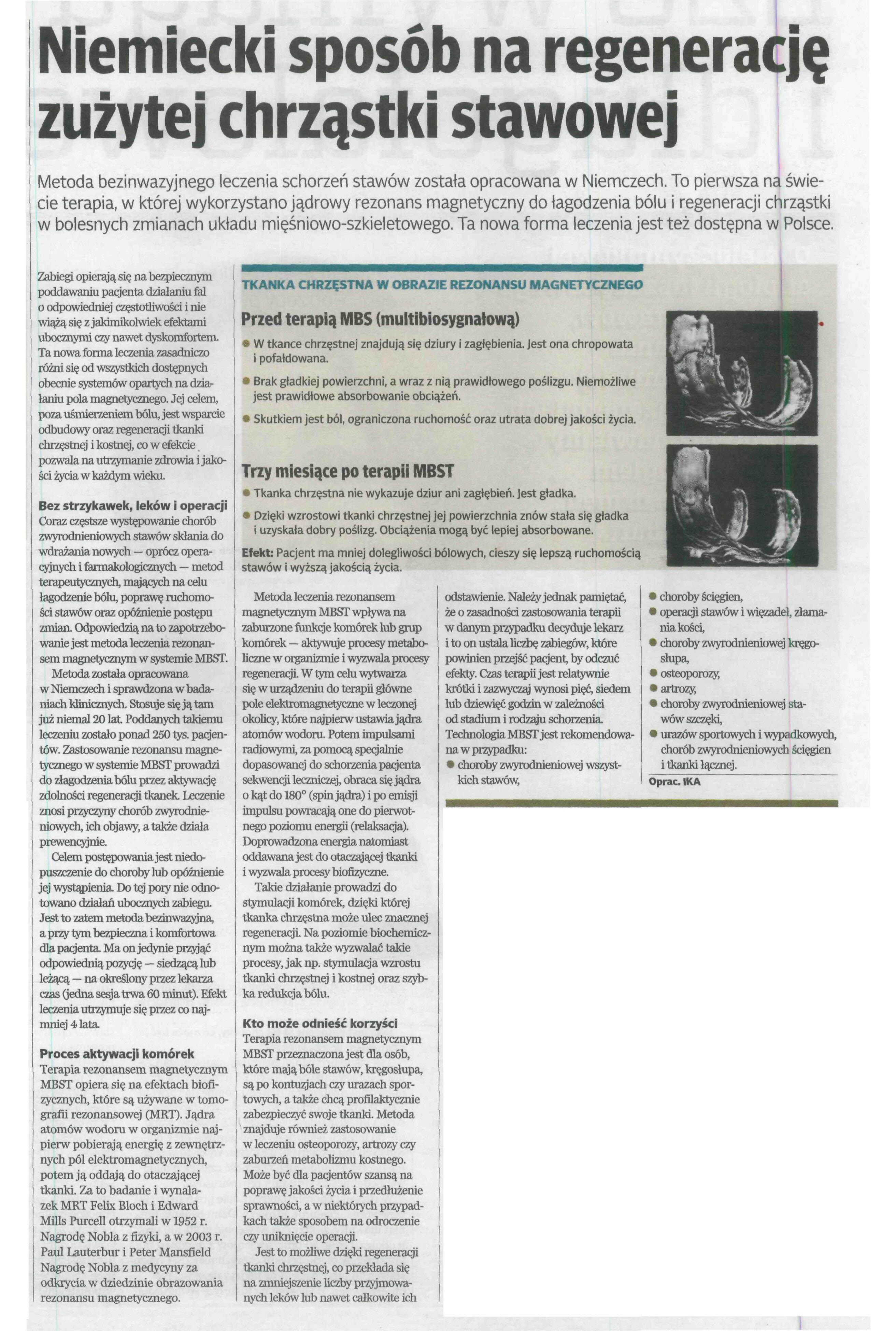 puls_medycyny_2017_04_05_niemiecki_sposob_na_regeneracje_zuzytej_chrzastki_stawowej__jpg_bn_1